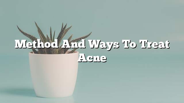 Method and Ways to treat acne