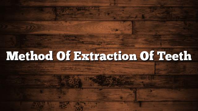 Method of extraction of teeth