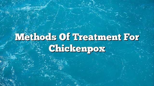 Methods of treatment for chickenpox