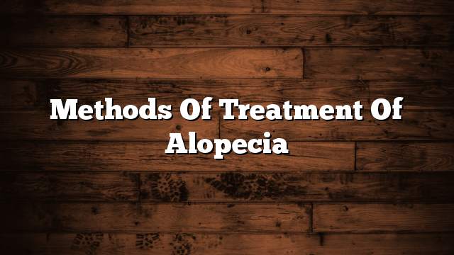 Methods of treatment of alopecia