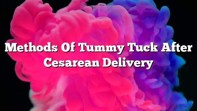 Methods of tummy tuck after cesarean delivery