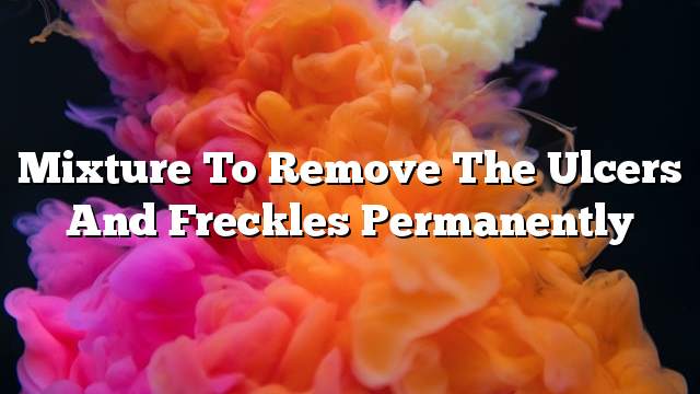 Mixture to remove the ulcers and freckles permanently
