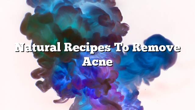 Natural recipes to remove acne