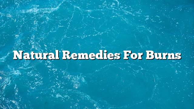 Natural remedies for burns
