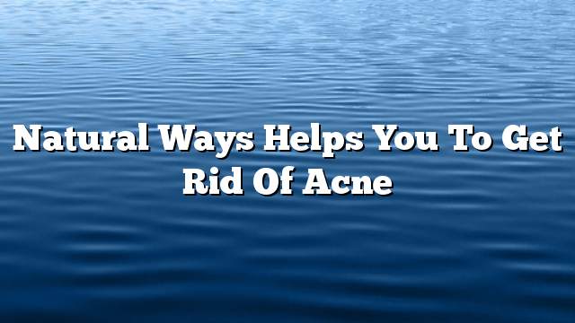 Natural ways helps you to get rid of acne
