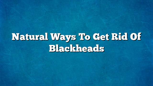 Natural ways to get rid of blackheads