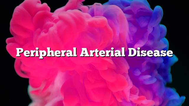 Peripheral arterial disease