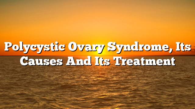 Polycystic Ovary Syndrome, its causes and its treatment