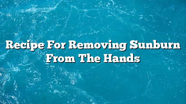 Recipe for removing sunburn from the hands