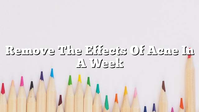 Remove the effects of acne in a week