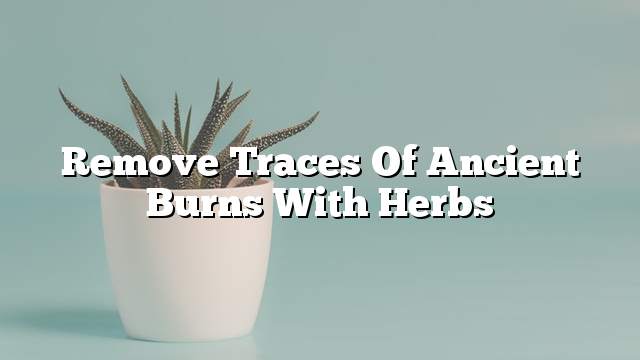 Remove traces of ancient burns with herbs