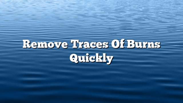 Remove traces of burns quickly