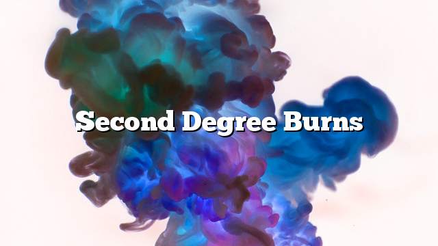 Second degree burns