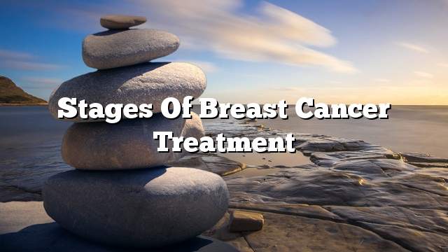 Stages of breast cancer treatment