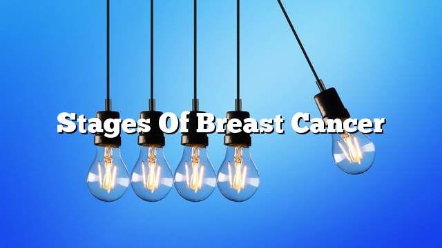 Stages of breast cancer