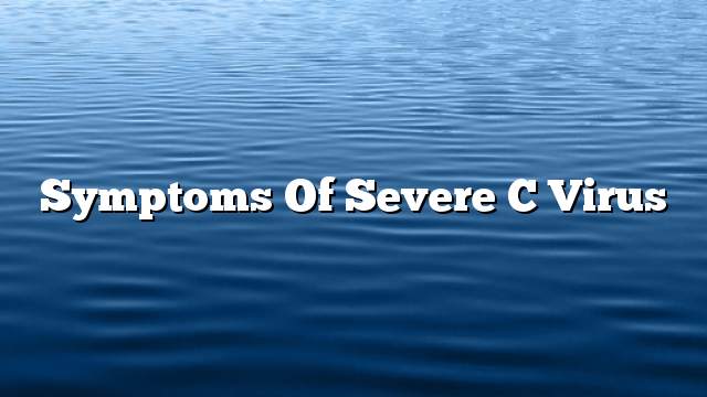 Symptoms of Severe C virus