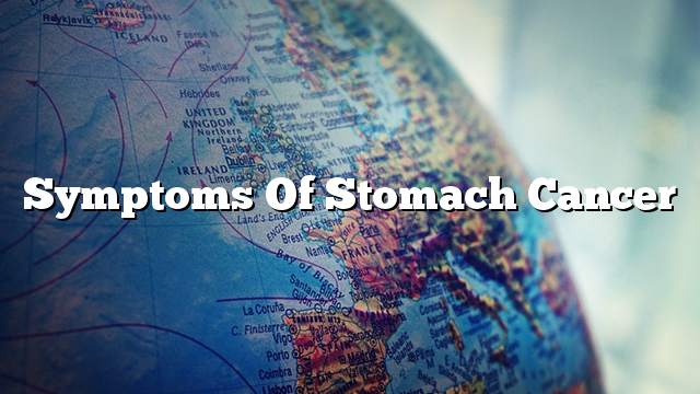 Symptoms of stomach cancer