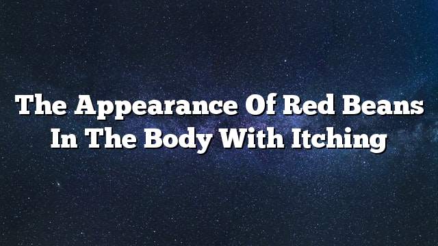 The appearance of red beans in the body with itching