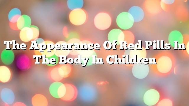 The appearance of red pills in the body in children