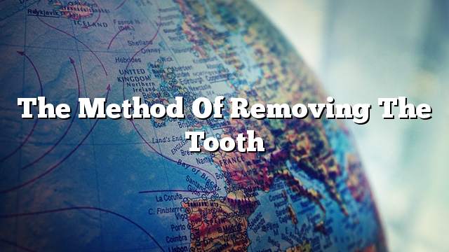 The method of removing the tooth