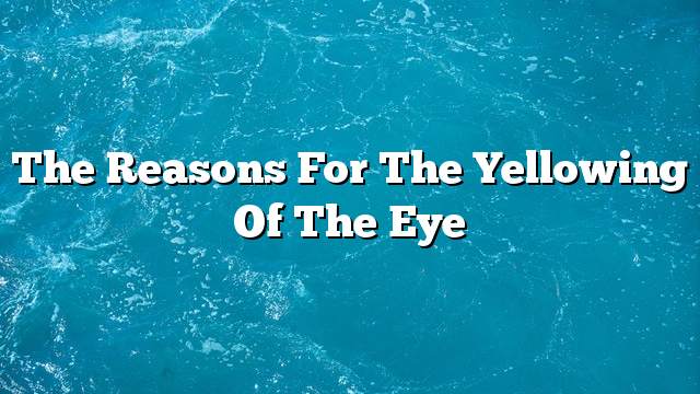 The reasons for the yellowing of the eye