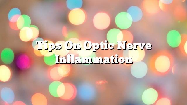 Tips on optic nerve inflammation