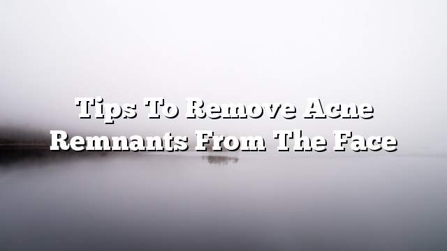 Tips to remove acne remnants from the face