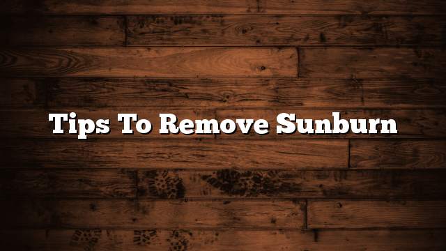 Tips to Remove Sunburn