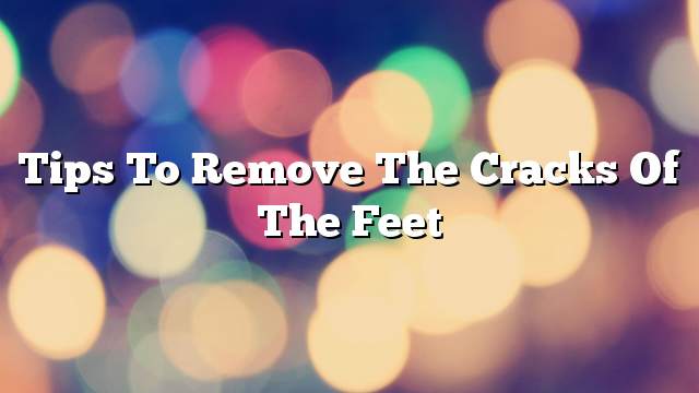 Tips to remove the cracks of the feet