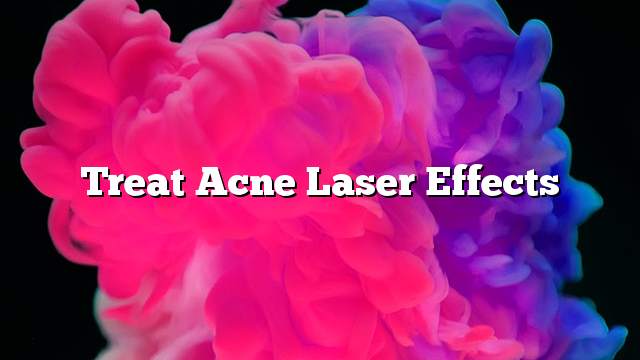 Treat acne laser effects