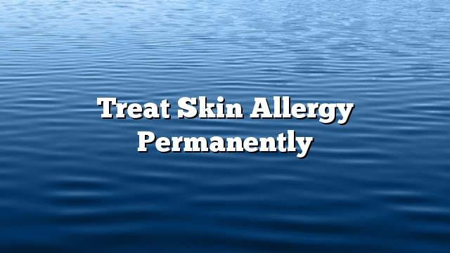 Treat skin allergy permanently