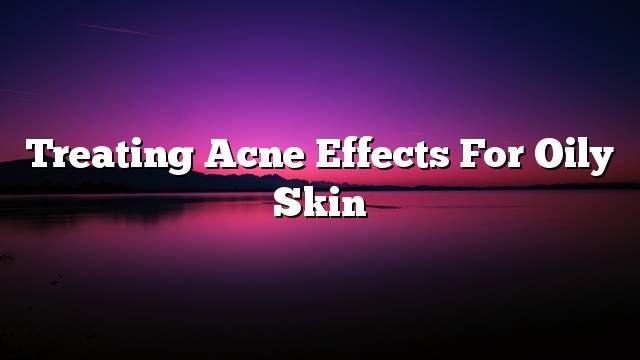 Treating acne effects for oily skin