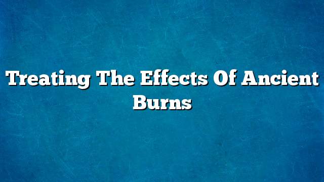 Treating the effects of ancient burns