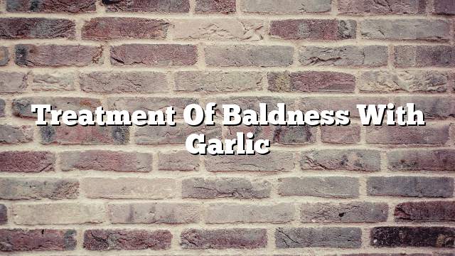 Treatment of baldness with garlic