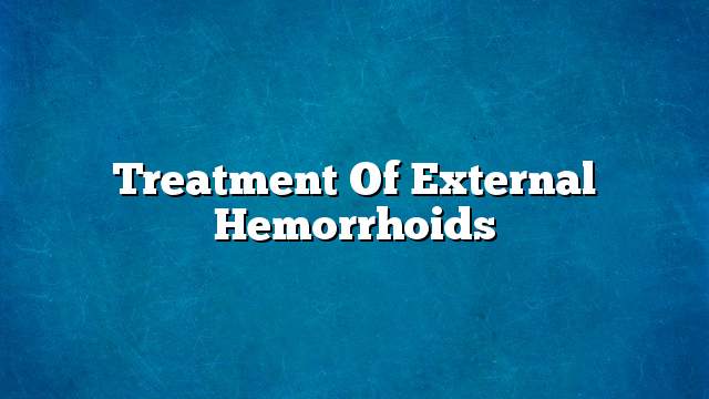 Treatment of external hemorrhoids