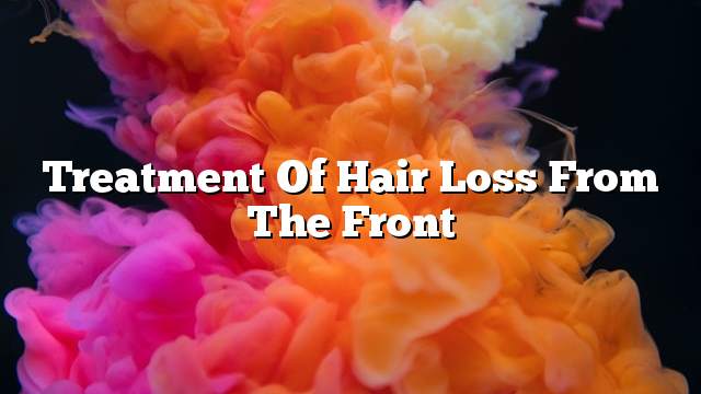 Treatment of hair loss from the front