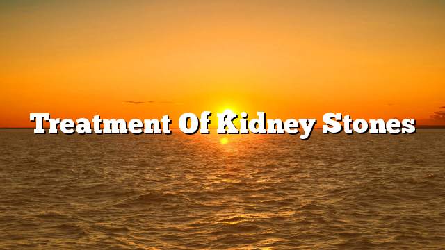 Treatment of kidney stones