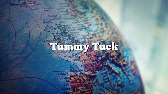 Tummy tuck