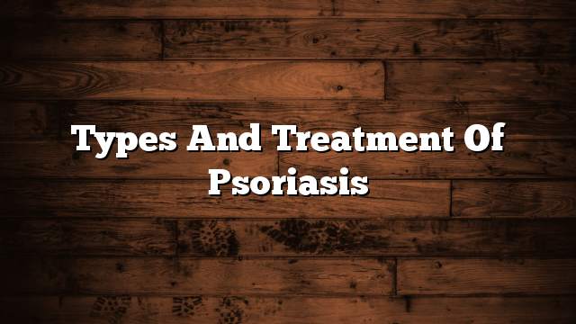 Types and treatment of Psoriasis