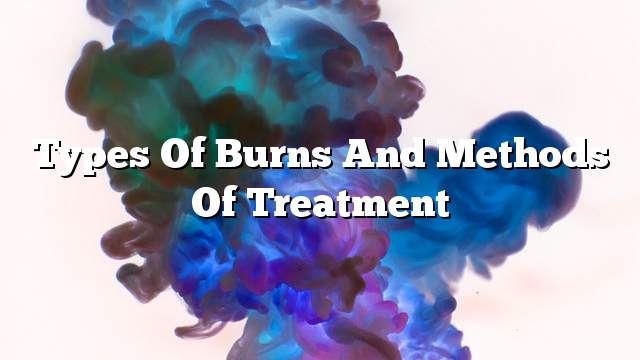 Types of burns and methods of treatment