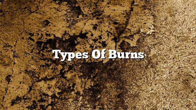 Types of burns
