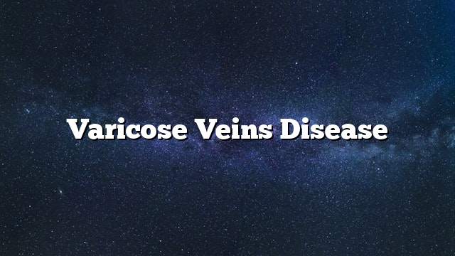 Varicose Veins Disease