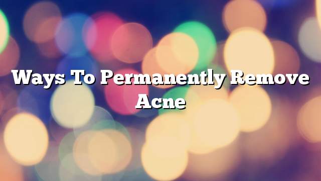 Ways to permanently remove acne