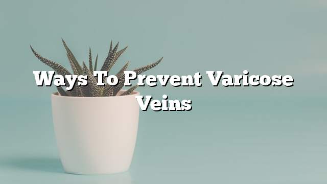 Ways to prevent varicose veins