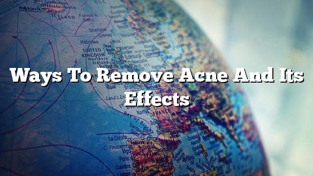 Ways to remove acne and its effects