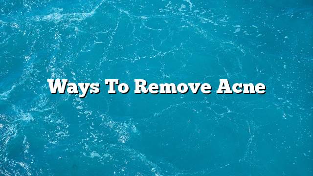 Ways to remove acne