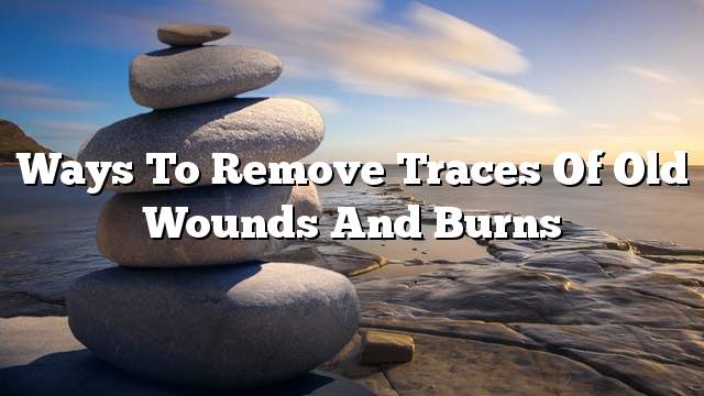 Ways to remove traces of old wounds and burns