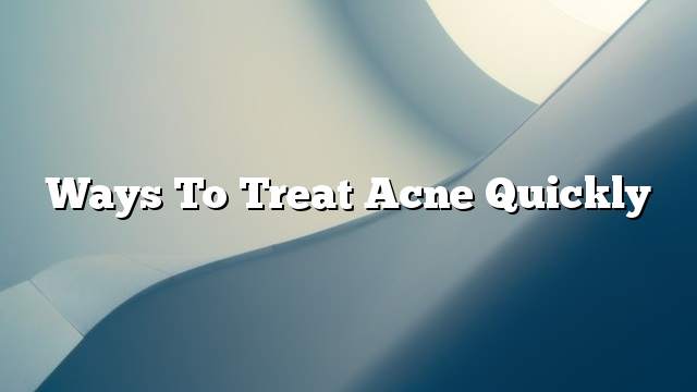 Ways to treat acne quickly