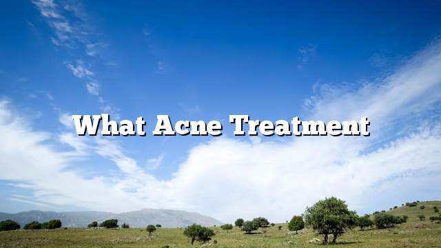 What acne treatment