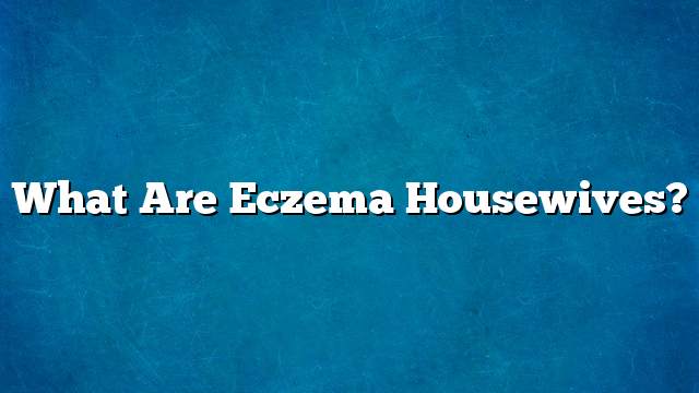 What are eczema housewives?